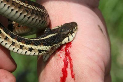 Síntomas De Mordedura De Serpiente Y Tratamiento De Primeros Auxilios