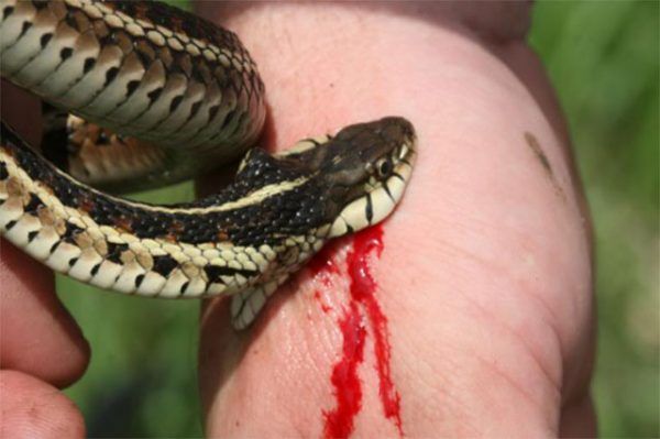 Síntomas De Mordedura De Serpiente Y Tratamiento De Primeros Auxilios